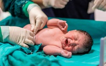 Dựng hình ảnh phổi trẻ sơ sinh từ những hơi thở đầu tiên