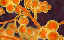 WHO công bố danh sách các loại nấm gây bệnh nhiễm trùng nguy hiểm nhất thế giới