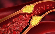 Các phát hiện mới liên quan tới lượng cholesterol trong máu