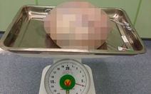 Mang khối u buồng trứng 6kg, người phụ nữ 66 tuổi nghĩ… mỡ bụng