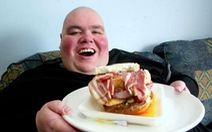 Người đàn ông béo nhất nước Anh kiện bệnh viện vì bắt giảm cân