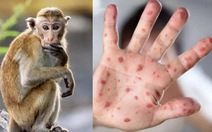 Long An phát hiện ca nhiễm đậu mùa khỉ là nhân viên nhà hàng làm ở TP.HCM