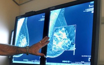 11 triệu chứng gợi ý ung thư vú mà không cần phải sờ thấy u