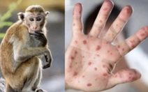 Ca bệnh đậu mùa khỉ đầu tiên tại Bến Tre đã tiếp xúc với 12 người, 1 người nghi bị lây