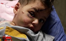 Rớt nước mắt phận trẻ mồ côi ở Gaza