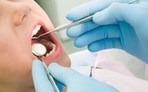 Có nên nhổ răng khôn?