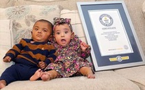 Hai em bé sinh non nhất thế giới đón sinh nhật đầu tiên