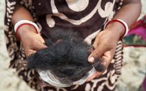 Phụ nữ Nam Á rụng tóc đến hói đầu vì buộc phải dùng nước bẩn