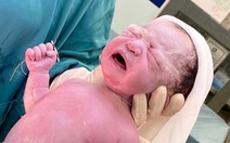 Tin tức sáng 14-6: Thú vị hình ảnh hai bé sơ sinh chào đời với vòng tránh thai trong tay
