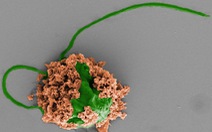 Robot tảo siêu nhỏ đưa thuốc trực tiếp tới phổi diệt ung thư