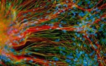 Dùng tế bào gốc tạo ra tế bào thần kinh vận động