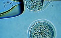 Tế bào mầm có thể hồi phục chấn thương tủy sống