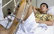 Trung Quốc cấm giải phẫu kéo dài chân