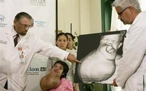 Bác sĩ Mỹ mổ khối u 7kg cho bé gái VN
