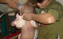 Đắc Nông: em bé 9 tháng tuổi bị "bảo mẫu" đánh đập dã man