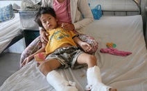 Đà Nẵng: một đứa trẻ bị chém đứt gân 2 chân