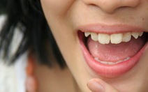 Giữ vệ sinh răng miệng để ngừa ung thư