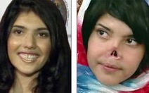 Gương mặt mới của cô gái Afghanistan bị cắt mũi