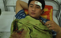 Quảng Nam: Lâm tặc tấn công, 4 kiểm lâm nguy kịch