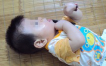 Bé trai mắc bệnh hiếm gặp qua Hàn Quốc chữa trị