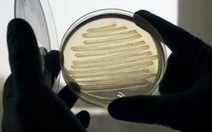Sản xuất nhiên liệu từ… vi khuẩn E.coli