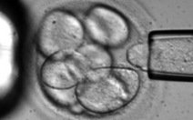 Da nhân tạo đầu tiên trên thế giới từ tế bào gốc