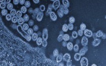 ​Virút cúm H7N9 đang nguy hiểm hơn