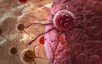 ​Phương pháp mới tiêu diệt tế bào ung thư đại trực tràng