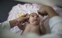 ​Virút Zika có thể gây mất mô não bào thai