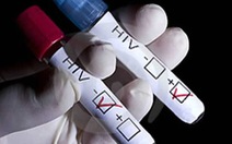 ​Điều kiện thực hiện xét nghiệm HIV bảo đảm