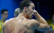 Michael Phelps dùng giác hơi để chữa đau cơ tại Olympic Rio