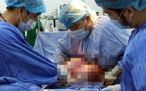 ​Phẫu thuật cắt khối u buồng trứng nặng 12 kg
