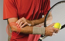 Hội chứng Tennis elbow - nguyên nhân và cách phòng ngừa