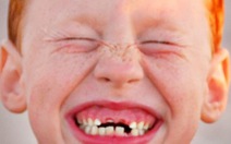 Câu hỏi trong tuần:lưu ý gì cho phát triển xương và răng trẻ?