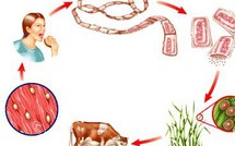 Phát hiện ổ bệnh 108 người nhiễm sán dây lợn tại Bình Phước