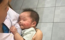 Bé gái 7 tháng tuổi bị bỏ bên đường, muỗi đốt chi chít mặt mũi
