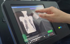 Bệnh nhân nhận kết quả X-quang chỉ sau vài giây nhờ AI