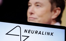 Công ty của tỉ phú Elon Musk tuyển người thử nghiệm cấy ghép não