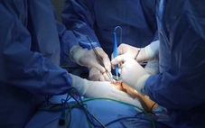 Chuyên gia Nhật Bản đánh giá cao kỹ thuật phẫu thuật robot trị ung thư ở Việt Nam