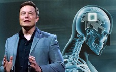 Neuralink của Elon Musk phát hiện sự cố sau ca cấy chip vào não người