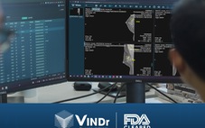 Sản phẩm AI của VinBigdata đạt chuẩn FDA, tiến vào thị trường Mỹ