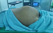 Cứu chữa bệnh nhân người Lào mang 4,5 lít mủ, bụng to như mang thai 8 tháng