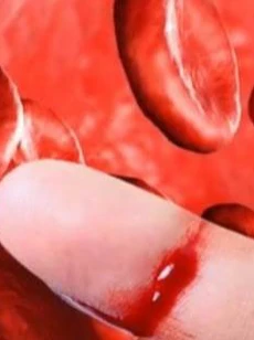 Chi phí điều trị người mắc bệnh máu khó đông là 10 triệu đồng/ngày