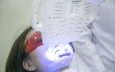 Các phương pháp tẩy trắng răng hiệu quả và an toàn