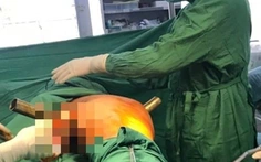 Cấp cứu thành công nam thanh niên bị ống sắt dài 50cm đâm xuyên vùng bẹn