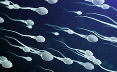 Kỹ thuật tránh thai lâu dài cho nam giới