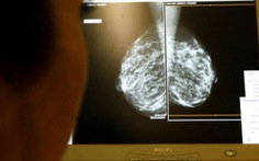 Mỹ tiêm thử nghiệm virus tiêu diệt ung thư trên người