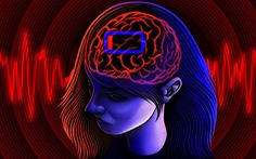 Não có thể bật chế độ ‘siêu tiết kiệm pin’ như điện thoại
