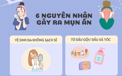 Điều trị mụn ẩn cần thay đổi ngay những thói quen này