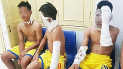 3 cầu thủ U14 SLNA nhập viện vì chùm bóng bay phát nổ